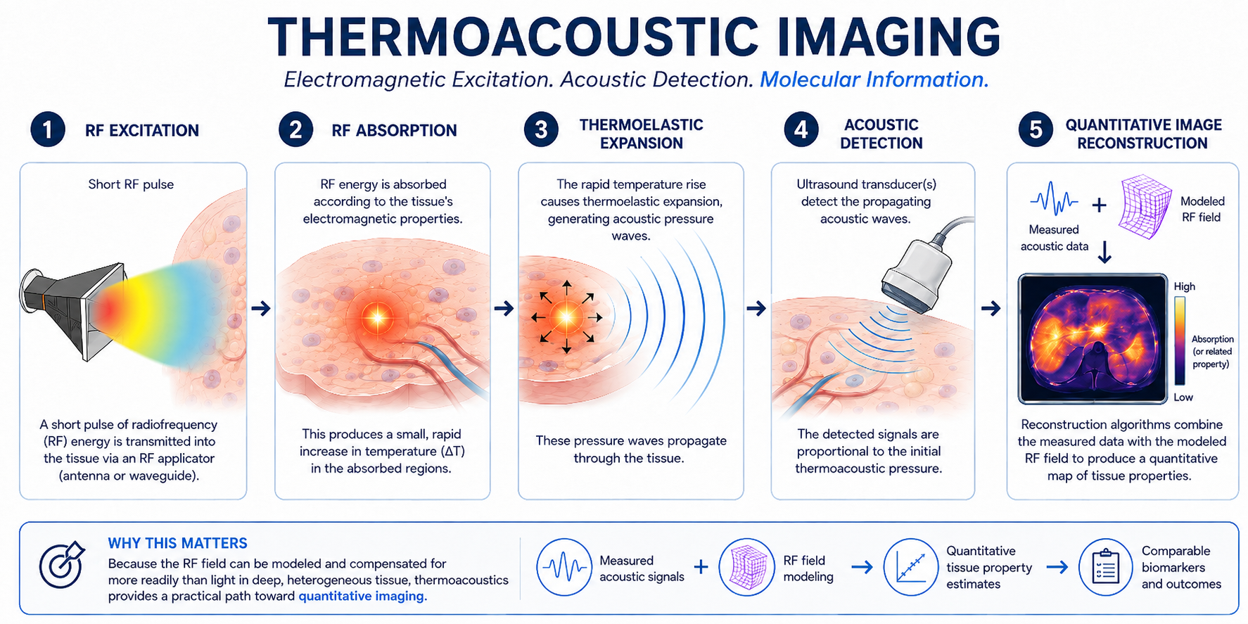 Thermoacoustic imaging process diagram